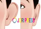 Ear Reshaping in Islamabad: Enhance Your Facial Harmony
