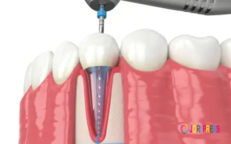 Latest Advances in Rotary Endodontics: Transforming Modern Root Canal Therapy  