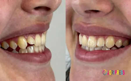 How Orthodontics Improves Smile Aesthetics