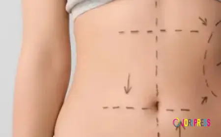 Liposuction in Islamabad – Achieve Your Ideal Body Shape