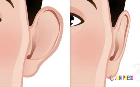 Ear Reshaping in Islamabad: Enhance Your Facial Harmony