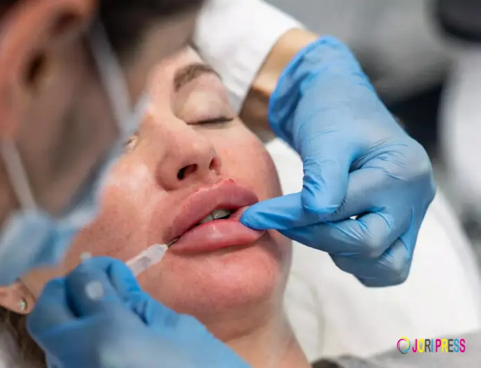 How Often Should You Get Lip Filler Touch-Ups