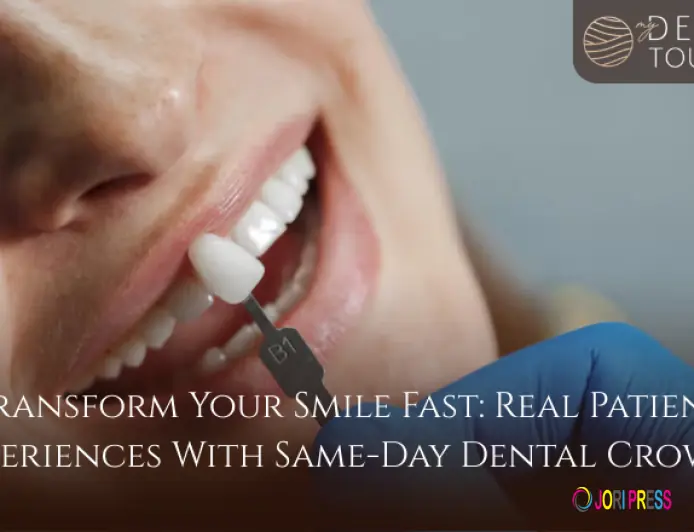 Transform Your Smile Fast: Real Patient Experiences With Same-Day Dental Crowns