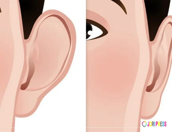 Ear Reshaping in Islamabad: Enhance Your Facial Harmony