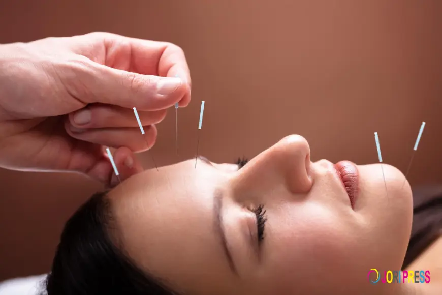 Acupuncture in Hollywood, FL: Natural Healing for Pain and Wellness