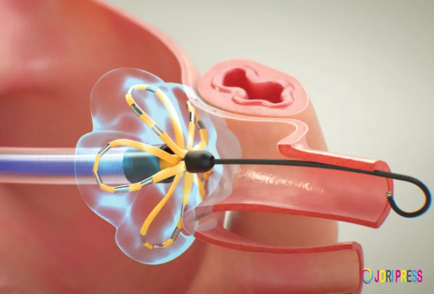 Atrial Fibrillation Device Market Future Shaped by Artificial Intelligence Enabled Cardiac Diagnostic Technologies Adoption.