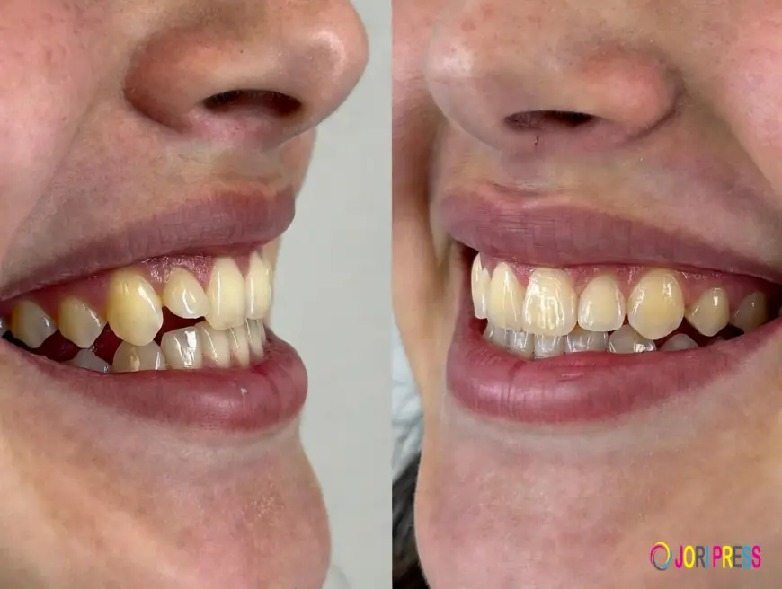How Orthodontics Improves Smile Aesthetics
