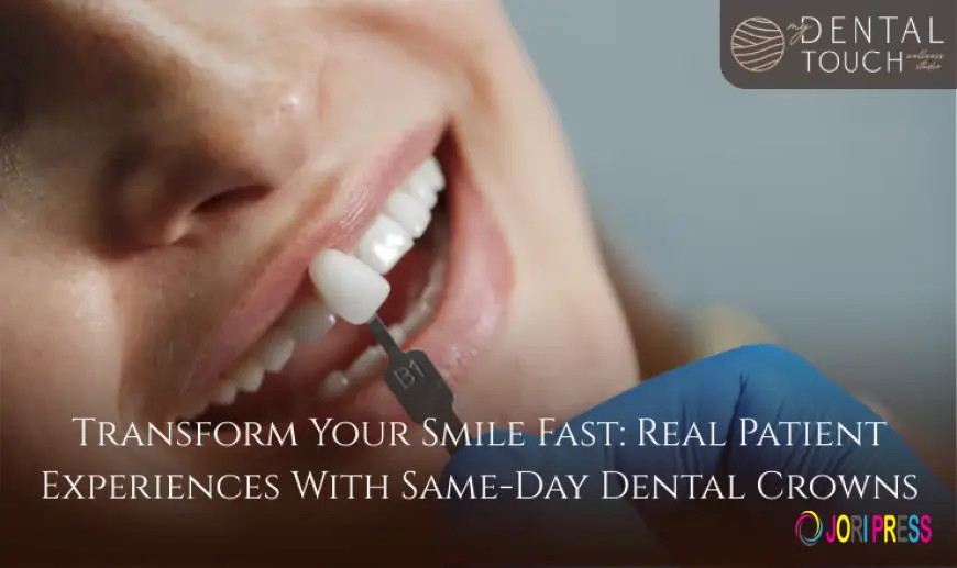 Transform Your Smile Fast: Real Patient Experiences With Same-Day Dental Crowns