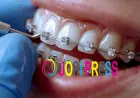 Perfect Your Smile with Dental Braces in Islamabad