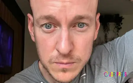 Want Hair Ltd Introduces Next-Generation Solutions for Best Hair Loss Treatment UK