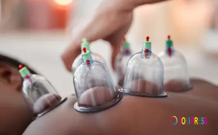 A&M Health Clinic Introduces Advanced Cupping Therapy in London for Pain Relief and Detox