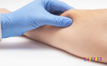 Modern Lipoma Solution in Islamabad – Look & Feel Best