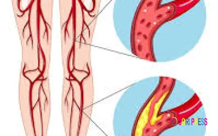 How to Choose the Right Pad Treatment for Sensitive Skin