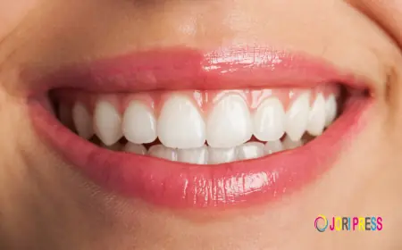 Teeth Whitening in Washington: Achieve a Brighter, Confident Smile
