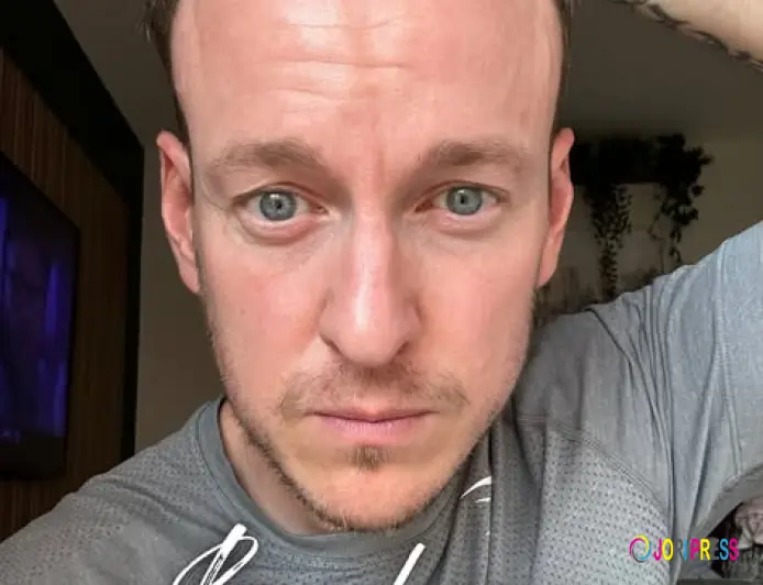 Want Hair Ltd Introduces Next-Generation Solutions for Best Hair Loss Treatment UK