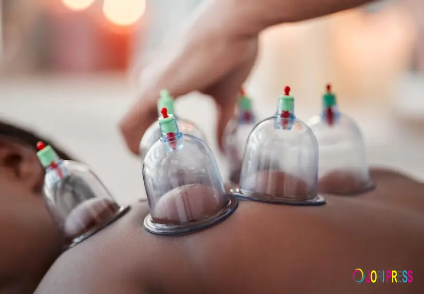 A&M Health Clinic Introduces Advanced Cupping Therapy in London for Pain Relief and Detox