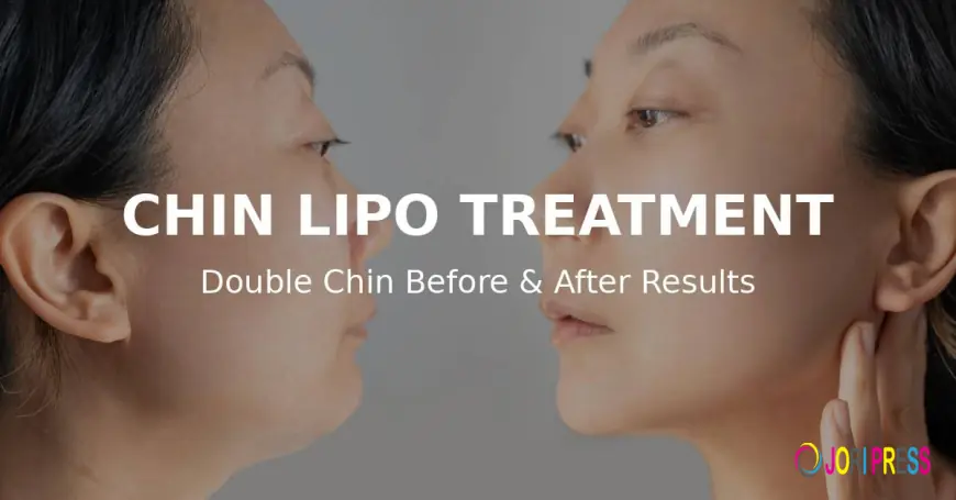 Transform Your Confidence: Chin Lipo Treatment in Islamabad