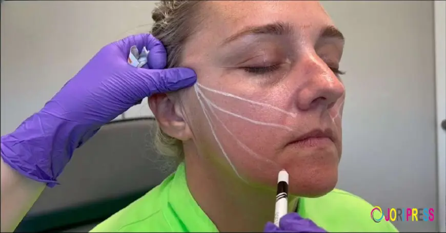 Instant Confidence Boost: Thread Lift in Islamabad