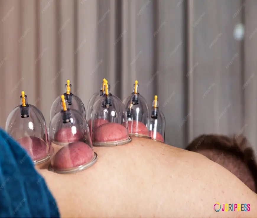 Flower of Life Introduces Professional Cupping Therapy in Portsmouth