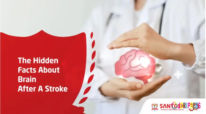 The Hidden Facts About the Brain After a Stroke