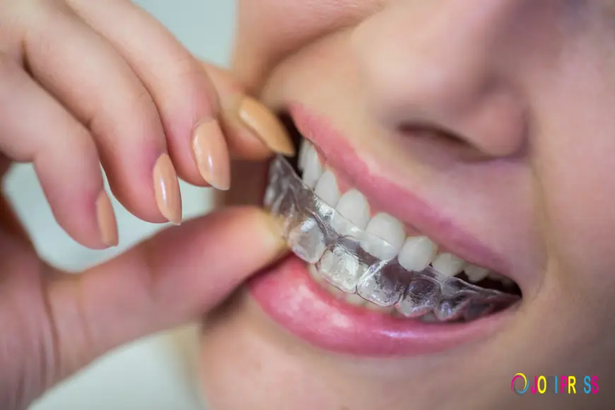 Do's and Don'ts While Using Invisalign Aligners for Best Results