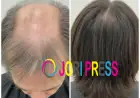 PRP Hair Treatment: Before and After Photos You Need to See