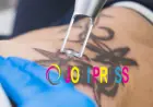 Tattoo Removal Cost What Factors Affect the Price