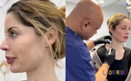 There Is Now a Non-Surgical Fix for a Double Chin and It Starts with a Lipolaser Treatment