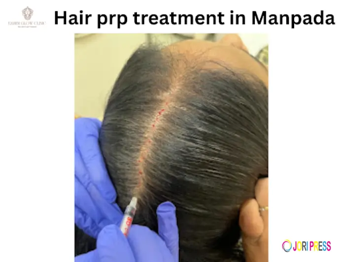 PRP Treatment in Manpada