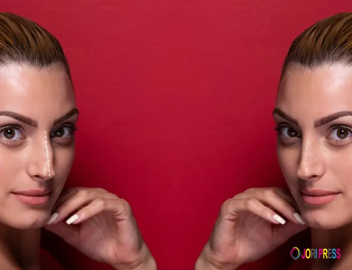 Morpheus8 vs Microneedling: Which Skin Tightening Treatment Is Right for You?