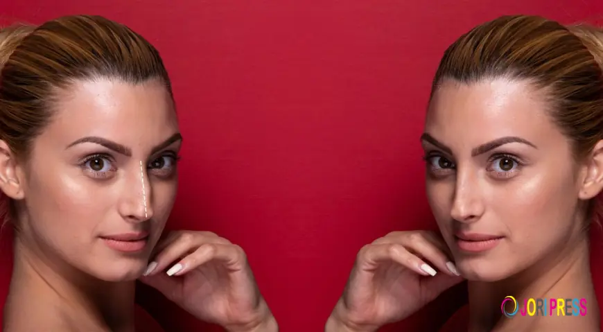 Morpheus8 vs Microneedling: Which Skin Tightening Treatment Is Right for You?