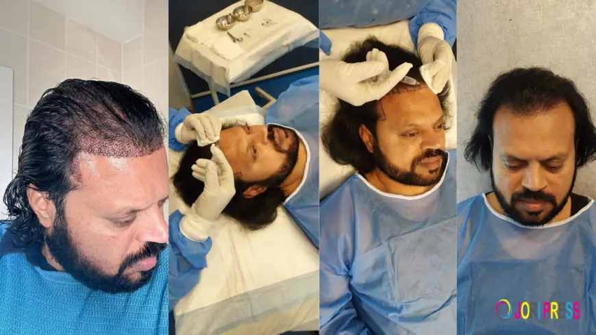 Balding at 30 in Pakistan? Here's Exactly How Much a Hair Transplant Will Cost You