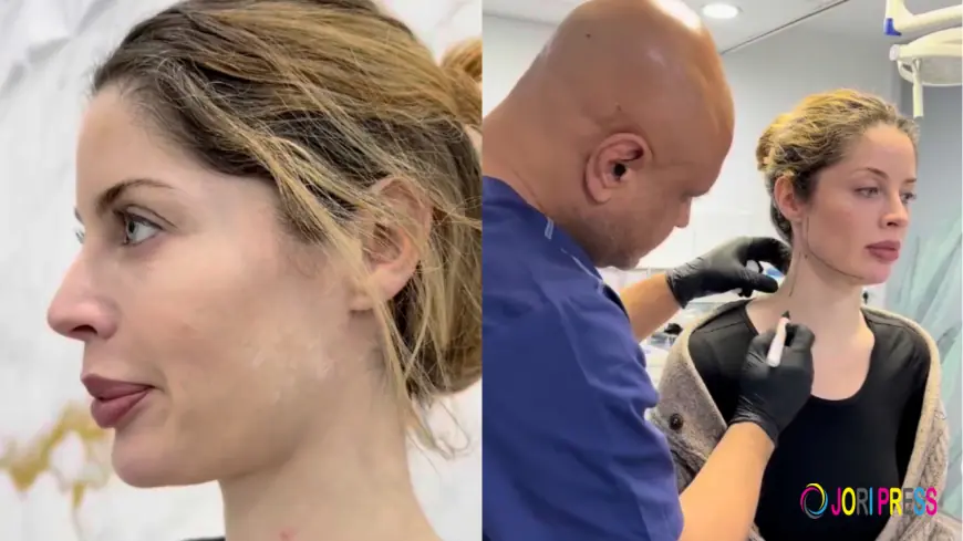 There Is Now a Non-Surgical Fix for a Double Chin and It Starts with a Lipolaser Treatment