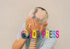 Professional Alopecia Treatment UK Services Gain Attention Through Want Hair Ltd