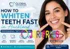Same-Day Teeth Whitening Near Me – Get a Brighter Smile Instantly