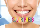Professional Teeth Whitening Services in Sharjah: A Simple Guide to a Brighter Smile
