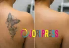 Laser Tattoo Removal in Sharjah: What You Should Know Before Starting