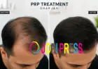 PRP Treatment in Sharjah: What You Should Know Before Starting