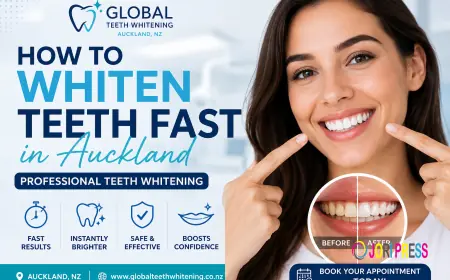 Same-Day Teeth Whitening Near Me – Get a Brighter Smile Instantly