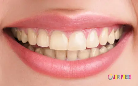 Wisdom Teeth Removal in Bhimavaram: Cost, Procedure & Recovery Guide