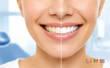 Professional Teeth Whitening Services in Sharjah: A Simple Guide to a Brighter Smile