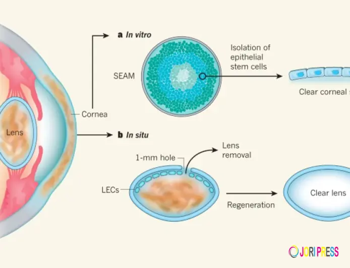 Affordable Stem Cell Therapy Services in India