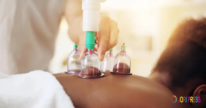 Flower of Life Launches Professional Cupping Therapy in Portsmouth