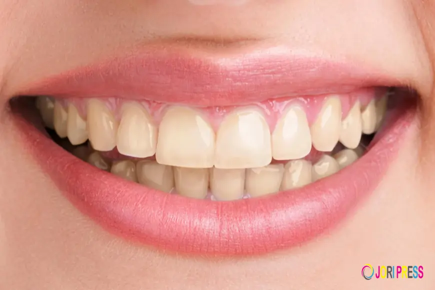 Wisdom Teeth Removal in Bhimavaram: Cost, Procedure & Recovery Guide