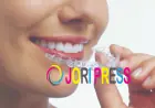 Clear Aligners Doctors in Bikaner: Expert Guidance for a Straighter, Healthier Smile