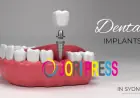 Dental Implant Cost Sydney: How to Plan Your Budget