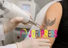 Tattoo Removal in Sharjah: Safe Laser Treatment for Unwanted Tattoos