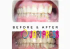 Comprehensive Oral Cancer Treatment Jaipur: From Precision Detection to Advanced Rehabilitation