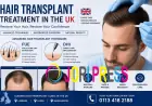 Hair Loss Treatment UK: Expert Guidance from Want Hair Ltd for Better Results