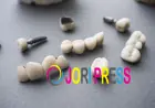 PFM Crowns and Bridges in Dubai – Durable and Natural-Looking Tooth Restoration